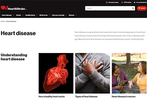 Heart-and-Stroke-Heart-Treatments-500x333